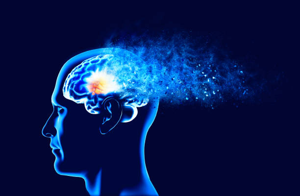 Alzheimer’s Disease