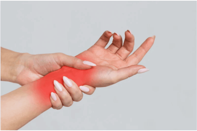 Is Nerve Pain a Rare Side Effect of Modafinil