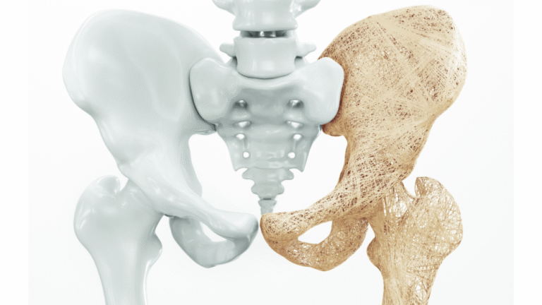 Can Modafinil Cause Bone Loss