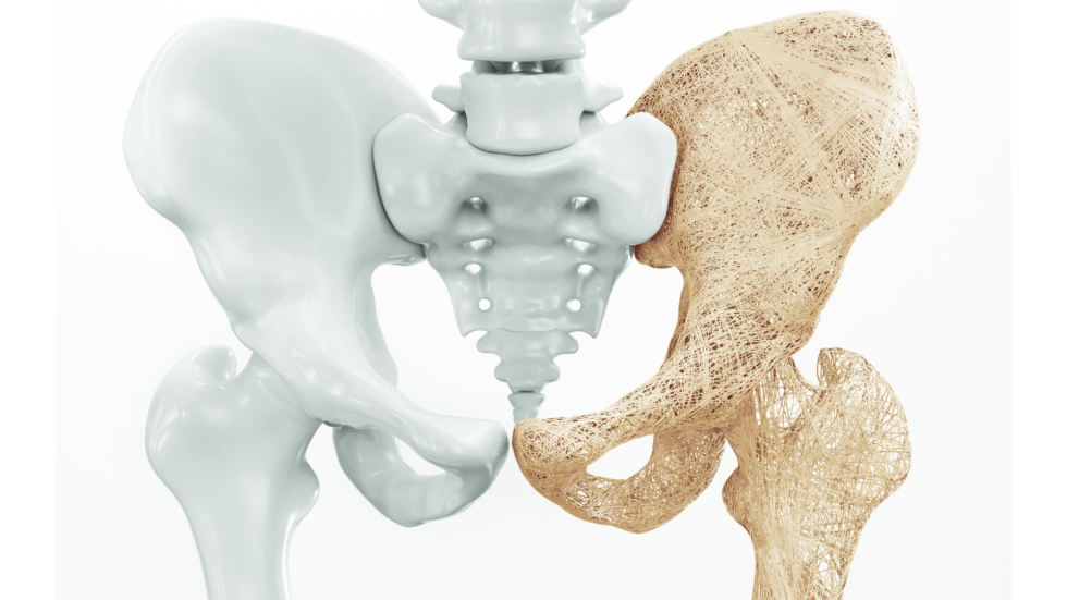 Can Modafinil Cause Bone Loss
