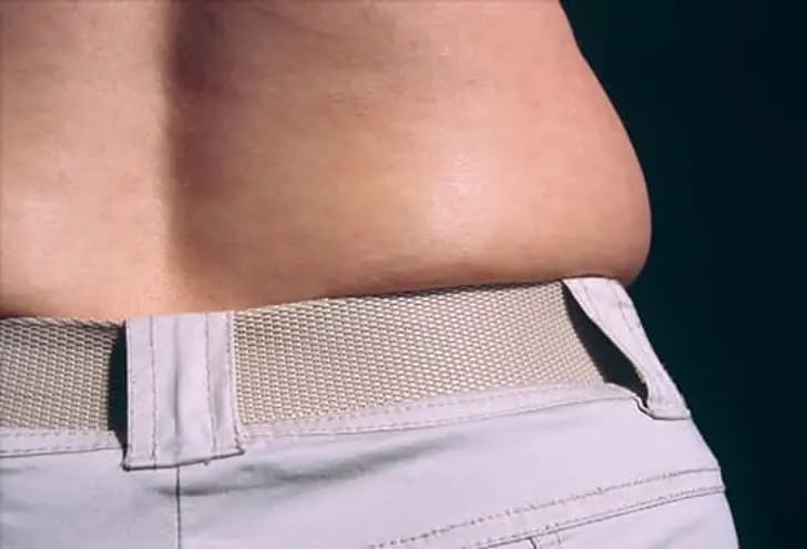 Modafinil and Weight Gain